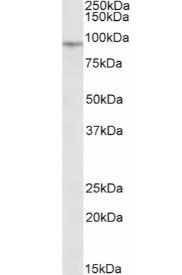 EWSR1 antibody