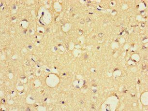 EXO1 Antibody