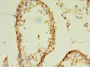 EXOSC5 antibody