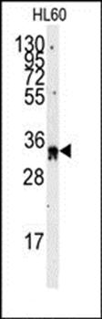 EXOSC8 antibody