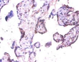 EXTL3 Antibody