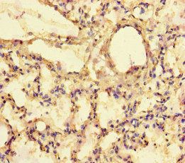 EXPH5 Antibody