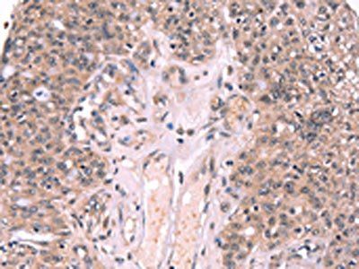 EXTL1 Antibody