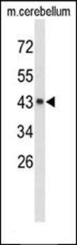 EXTL2 antibody