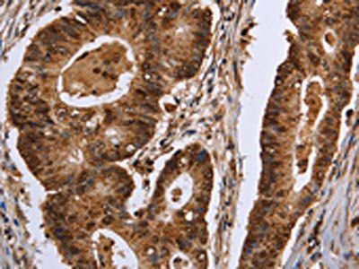 EXTL3 Antibody