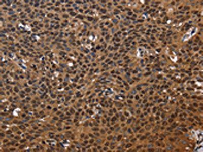 EXTL3 Antibody