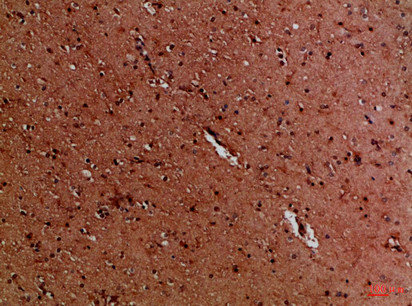EYA1/EYA4 Antibody