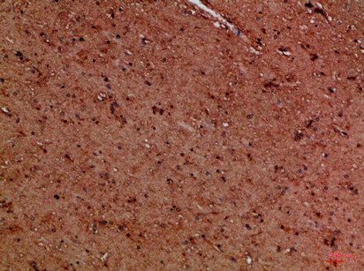 EYA1/EYA4 Antibody