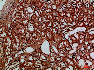 EYA1/EYA4 Antibody