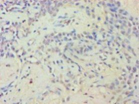 EYA2 Antibody
