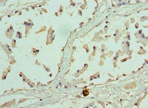 EZH1 antibody