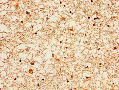 EZR Antibody