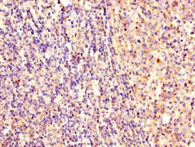 EZR Antibody