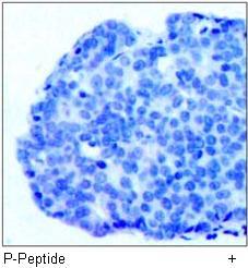 Ezrin (Phospho-Tyr353) Antibody