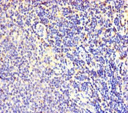FBXL18 Antibody