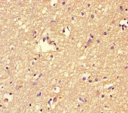 F-box/LRR-repeat protein 18 antibody