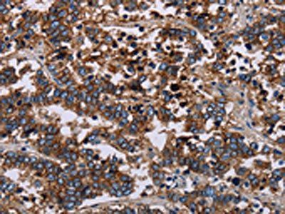 F11R Antibody