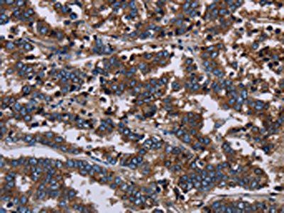 F11R Antibody