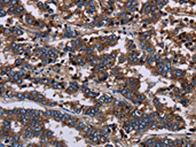 F11R antibody