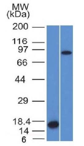 Factor XIIIa (Coagulation Factor XIIIA Chain) Antibody