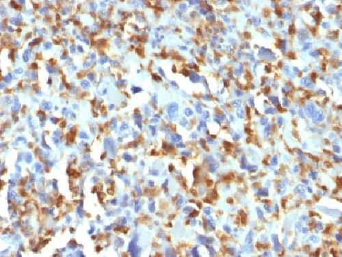 F13A1 Antibody