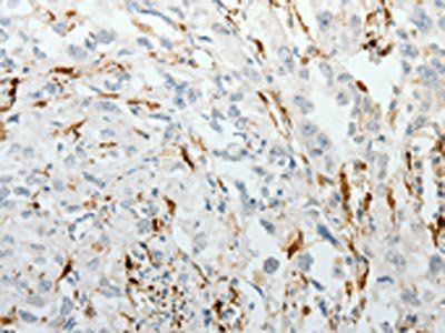 F13A1 Antibody