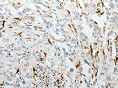 F13A1 antibody