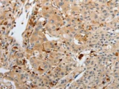 F13A1 Antibody