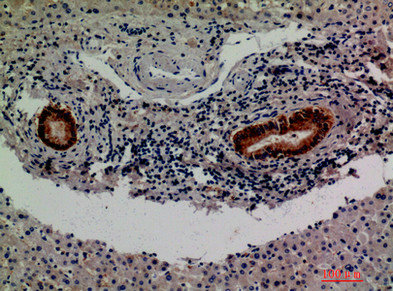 F13B Antibody