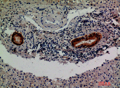 F13B antibody