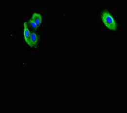 F2R antibody