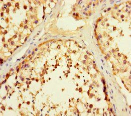 F2R Antibody