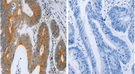 F2R Rabbit Polyclonal Antibody