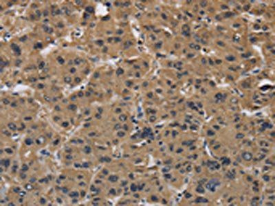 FABP2 Antibody