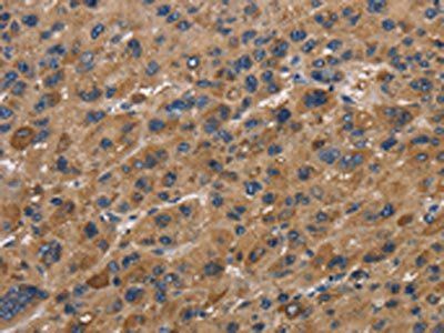 FABP2 Antibody