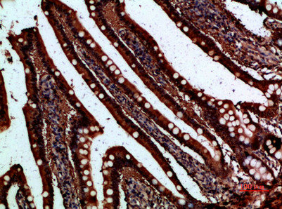 FABP2 Antibody