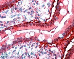 Goat anti-FABP2 Antibody