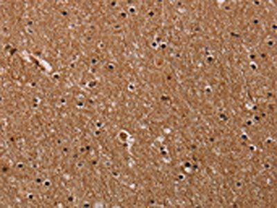 FABP3 Antibody
