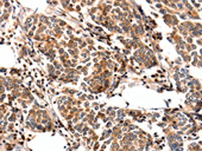 FABP7 Antibody