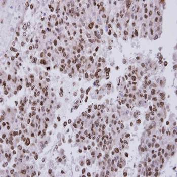 FACA antibody