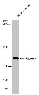 Factor H antibody