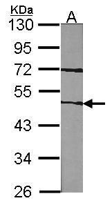 Factor VII antibody