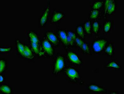 Factor VIII antibody