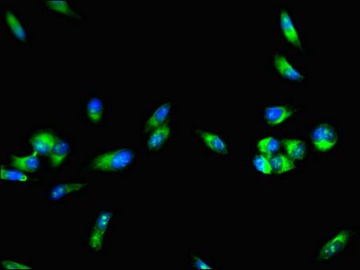 Factor VIII antibody