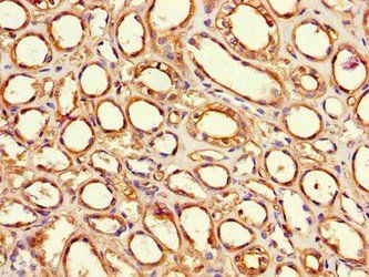 Factor VIII antibody