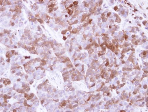 Factor XIIIa antibody [N1N3]