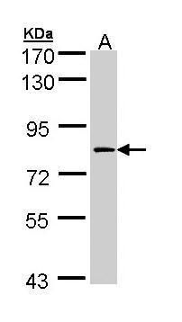 Factor XIII antibody