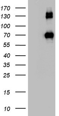 Factor XIIIa Antibody
