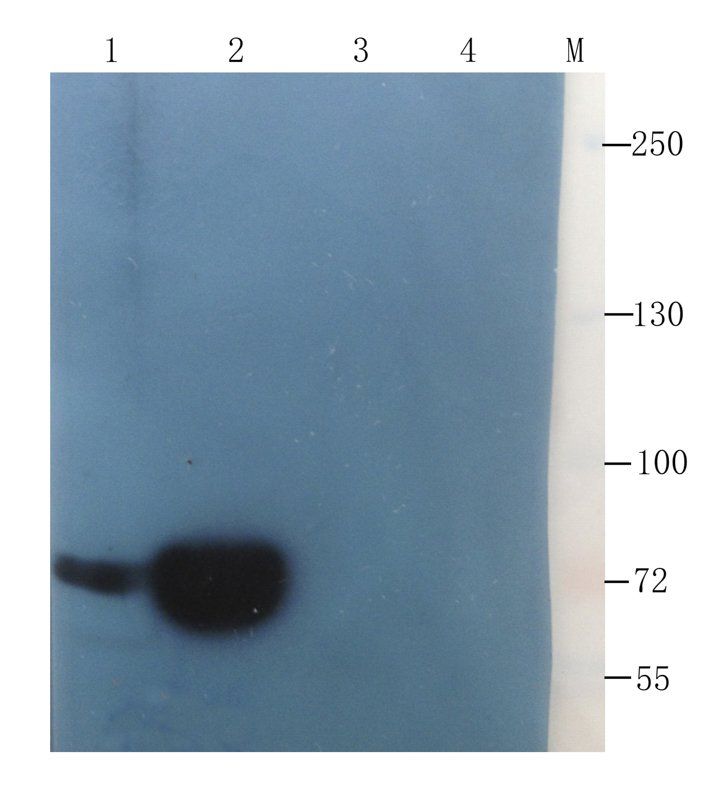 Factor VIII antibody