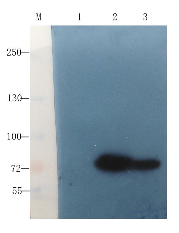 Factor VIII antibody